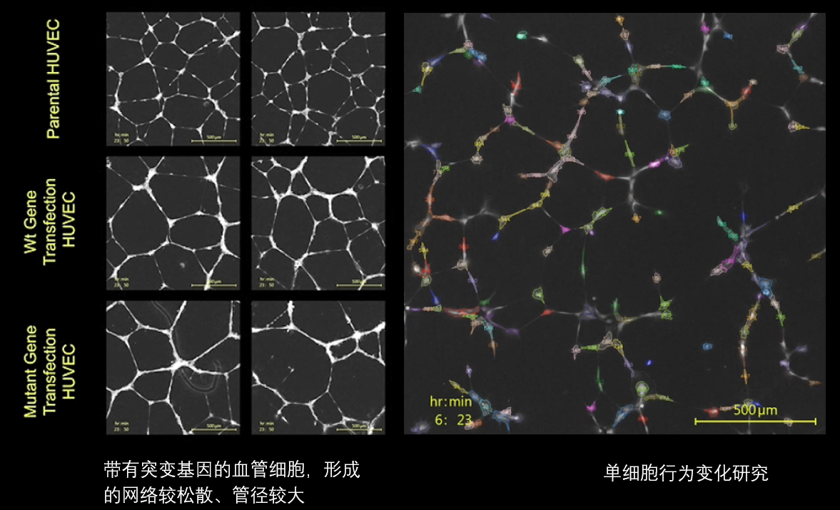6、血管分析.png