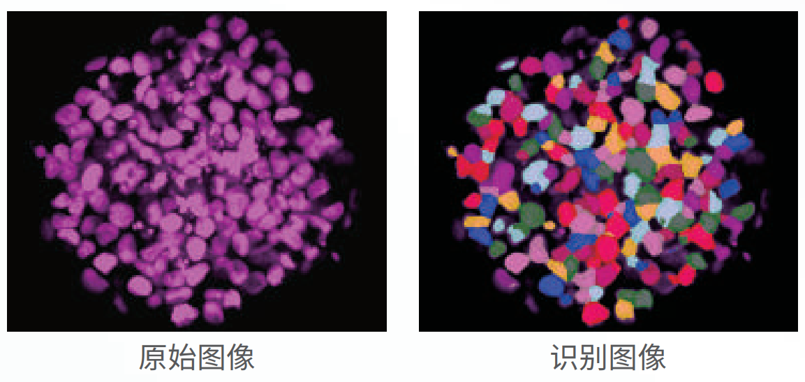 應(yīng)用3：類器官、球體成像.png